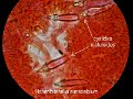 Hohenbuehelia auriscalpium-amf1464-(cystides)